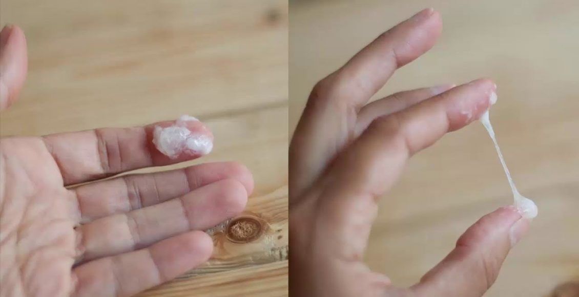 Khí hư bất thường cảnh báo bệnh gì?