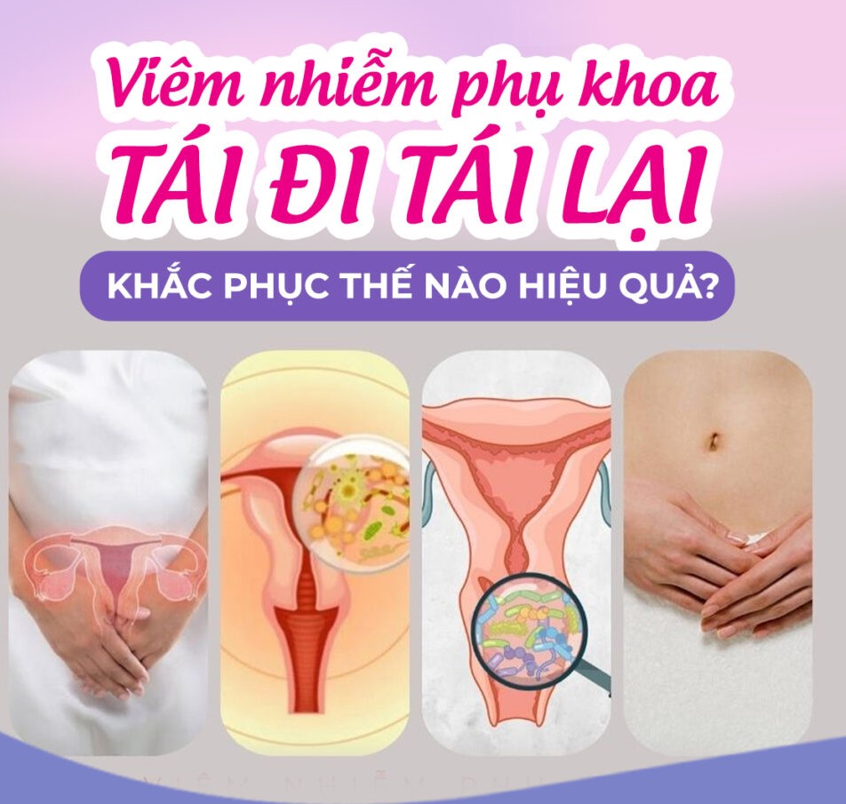 Nguyên nhân gây viêm nhiễm phụ khoa tái đi tái lại